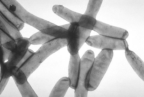 Legionella pneumophila - una neumonía que esta causando estragos en Argentina.